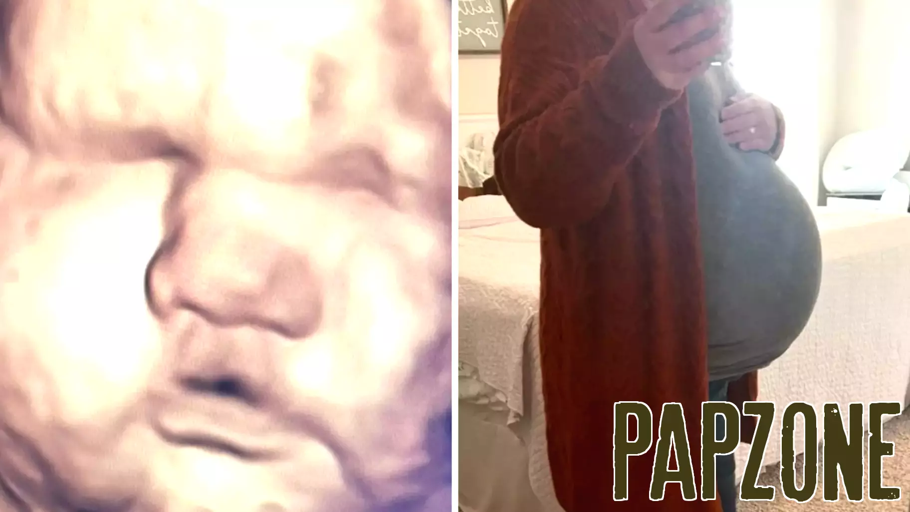 Hospital Adjustments Needed After 3D Scan Predicts Larger Baby
